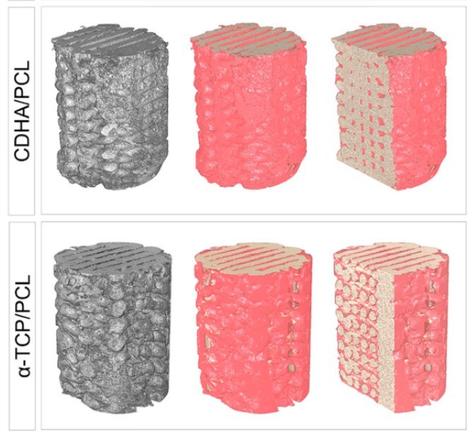 Breakthrough in Bone Regeneration: 3D-Printed Scaffold Hardens Inside the Body